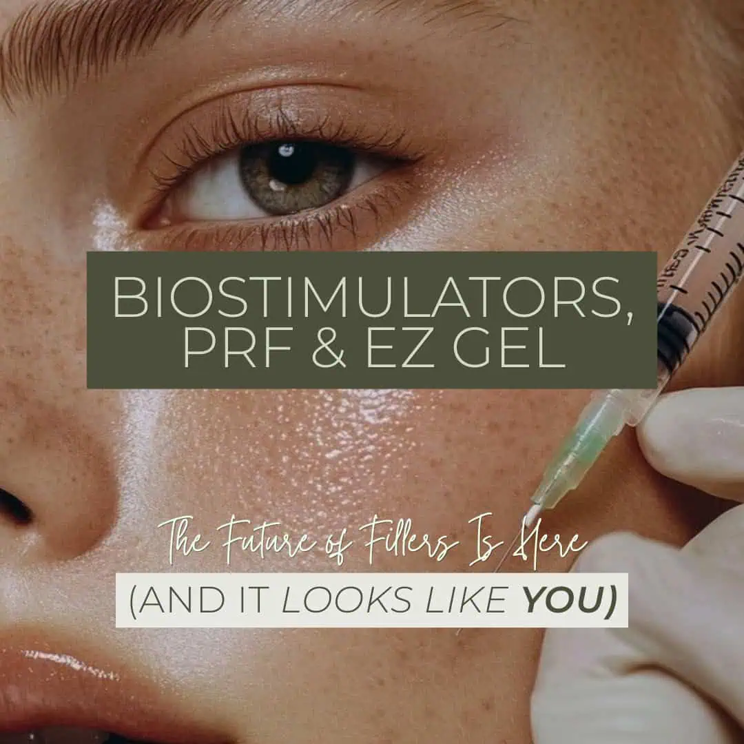 Biostimulators, PRF & EZ Gel: The Future of Fillers Is Here (And It Looks Like You)