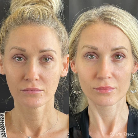 Aging Backwards + Props for Iris