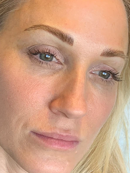 Brows, Botox, and Brightening