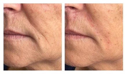 Butter for Your Face: Vollure Makes a Smooth Entrance