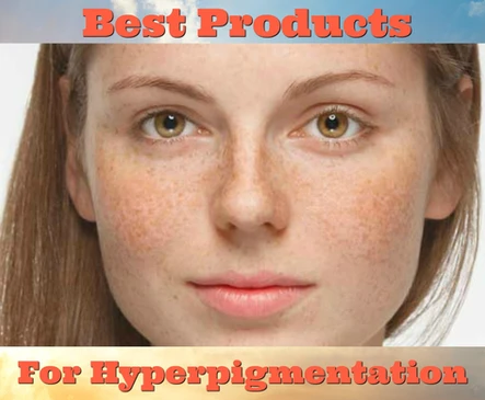 Even Up: Products for Pigment Issues