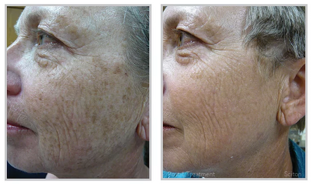 Fall is Coming: Get Out the Decorations + Get Off the Sun Damage!