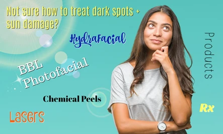 Five Options for Treating Your Dark Spots and Pigmentation