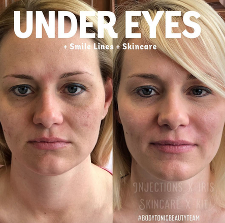 Five Ways to Make Your Eyes Pop