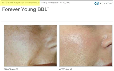 Fountain of Youth: Forever Young BBL