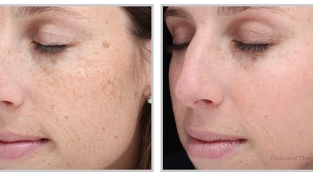 Hello Halo! A Deep Dive Into Treatment and Healing