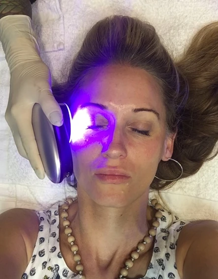 HydraFacial: The No Filter, No Makeup Needed Treatment