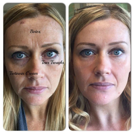 “I’m A Before Picture”: Deconstructing Spectacular Treatment Results