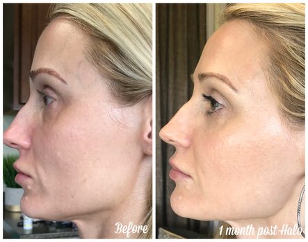 Kardashians, Crack Dip, and Changing Up the Anti-Aging Plan