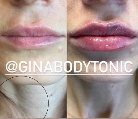 Notice the Lips, Not the Neck