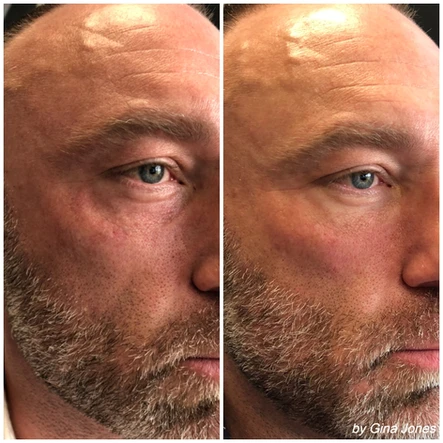 Treatments + Skincare for Men