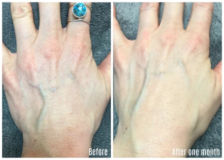 Whisper for Hands: Trying to Make My Hands Match My Face