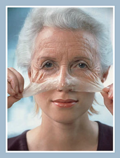 Prejuvenation: Preventative Botox
