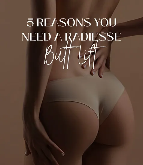 5 Reasons You Need A Radiesse Butt Lift