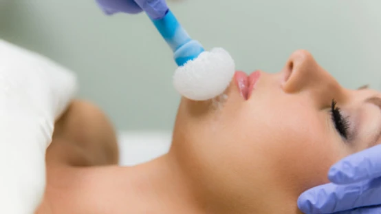 Glowing All The Way: A “No Peel” Peel