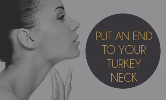 Only the Turkey Will Have a Waddle This Thanksgiving