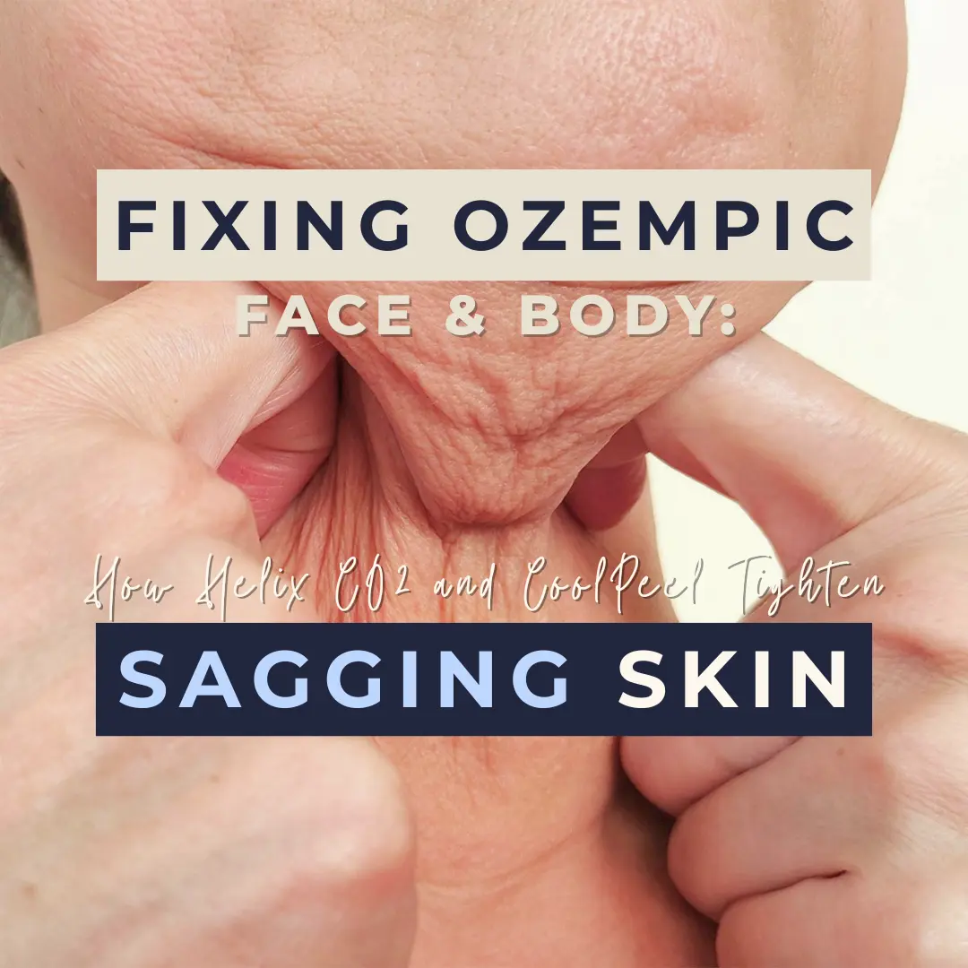 Fixing Face & Body: How Helix CO₂ and CoolPeel Tighten Sagging Skin