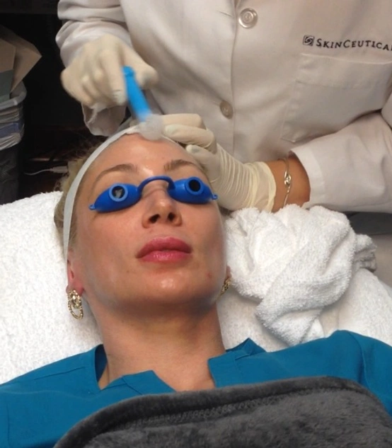 Skin Ceuticals Micropeel (and some Thanksgiving Gratitude) in Austin TX