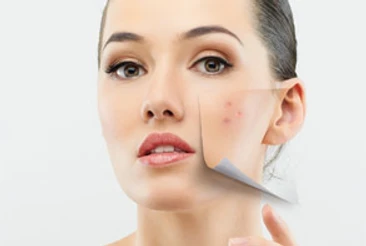 Body Tonic Teen Acne Do's and Don't's for the Plague on the Face! in Austin TX