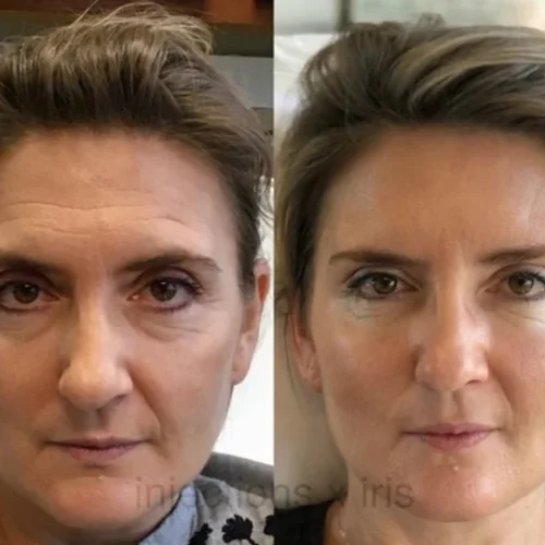 Body Tonic Medical Spa Clock Liquid Facelift D In Austin, TX